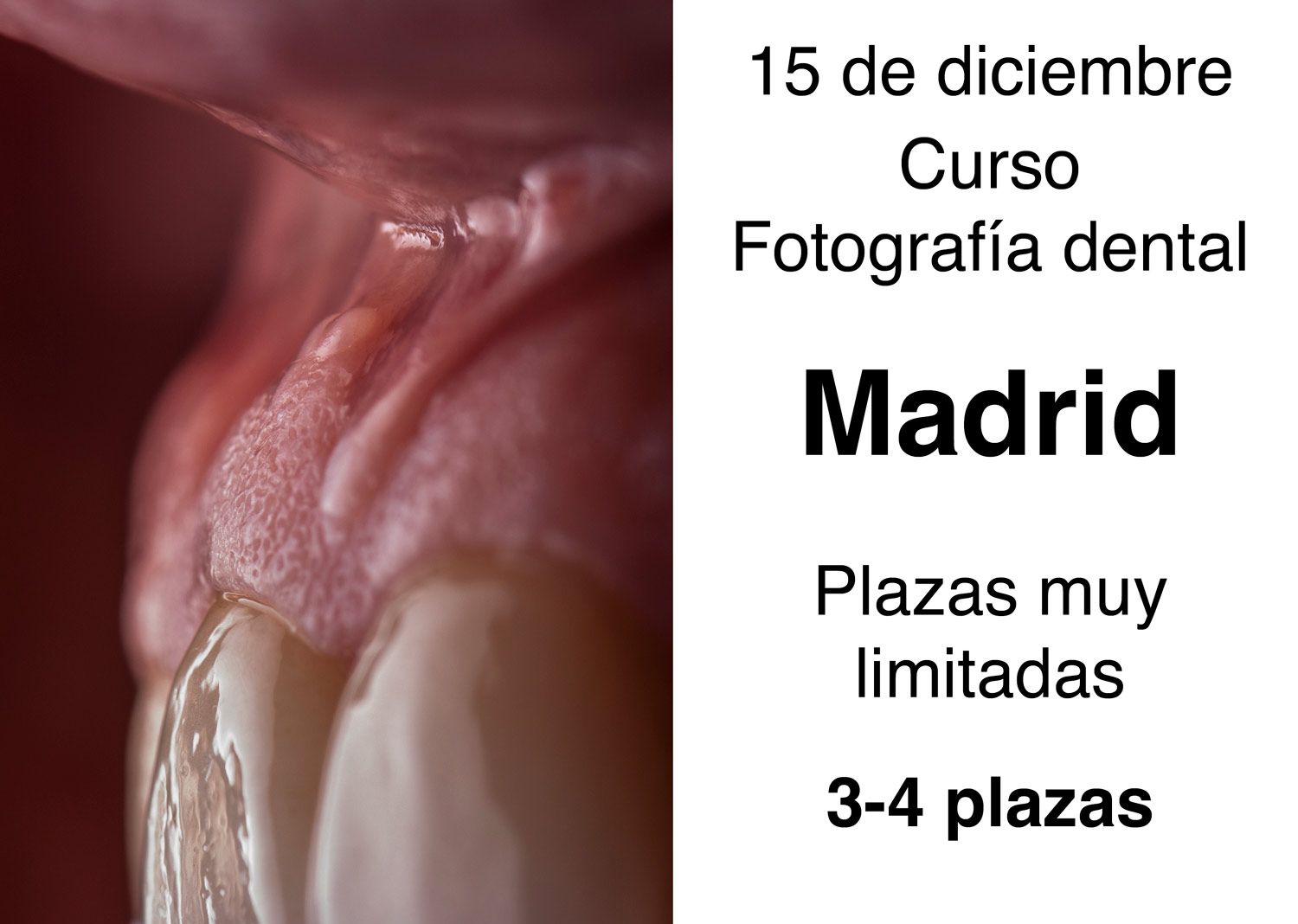 Curso-fotografia-dental-Madrid